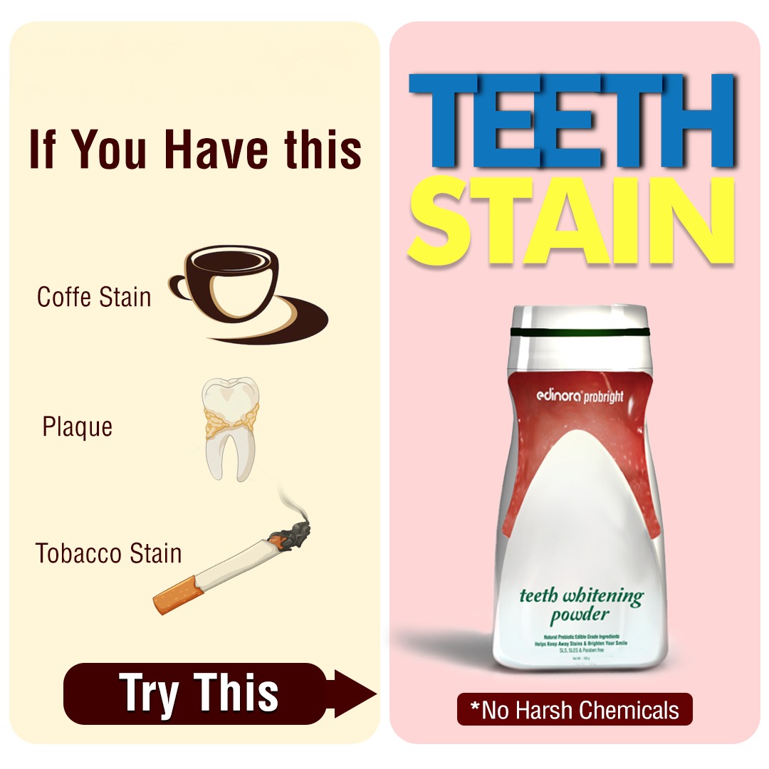 Edinora Probright Natural Teeth Whitening Powder | Mild Stain Remover, Mouth Freshener | Asparagus, Natural Kaolin Clay, Hadjod | 80g